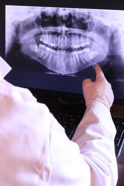 Best Emergency Tooth Extraction in Pea Ridge, FL