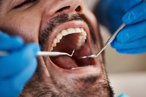 Best Emergency Broken Tooth Repair in Pea Ridge, FL